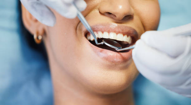 Best Walk-In Emergency Dentist in Sunnyside, WA